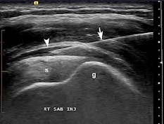 Diagnostic Ultrasound