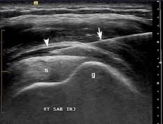 Diagnostic Ultrasound