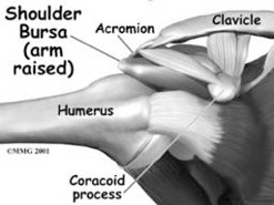 Impingement