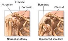 Shoulder Instability